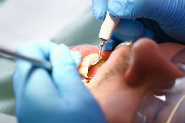 Best Emergency Treatment for Toothache in Albion, MI
