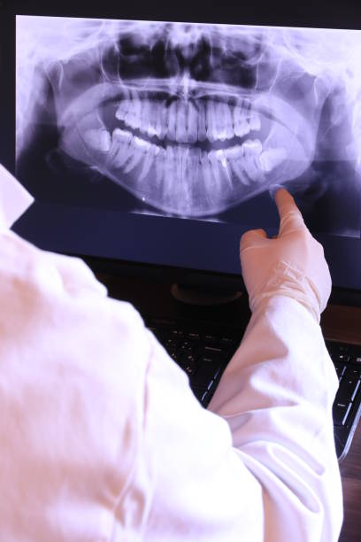 Best Emergency Wisdom Teeth Removal in Albion, MI