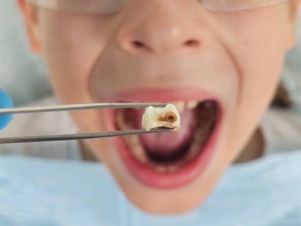 Best Pediatric Emergency Dentist in Albion, MI