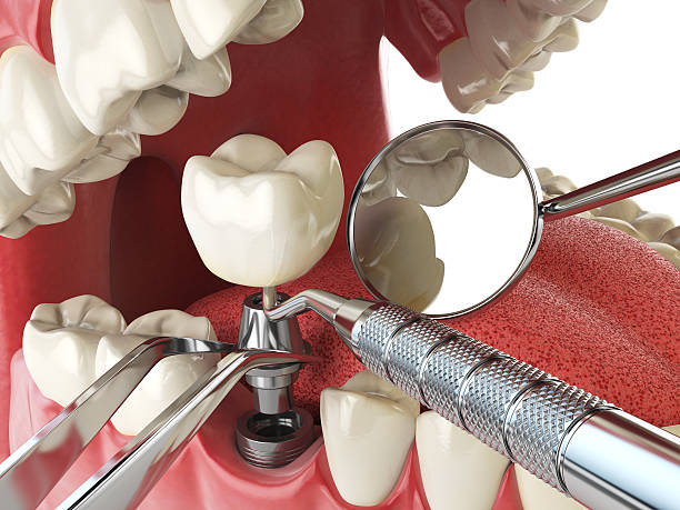 Best Emergency Dental Surgery in Albion, MI